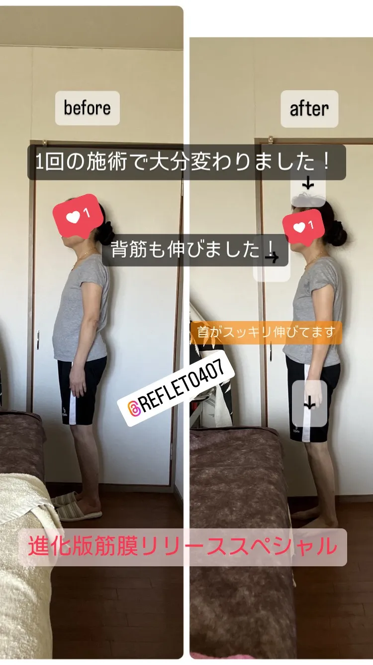 ルフレの神経矯正・筋膜リリース・骨格矯正