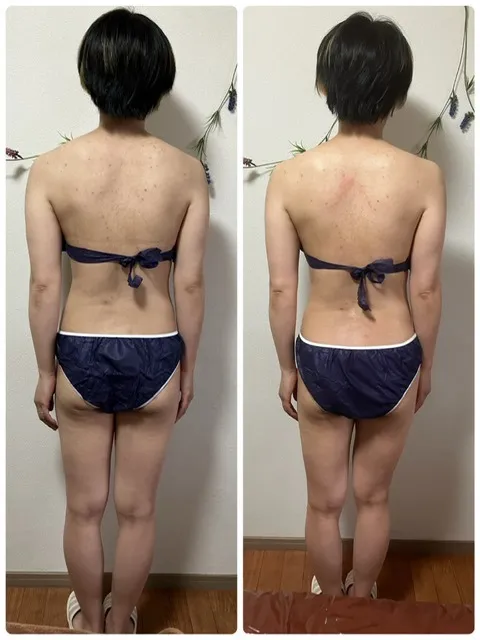 ルフレの神経矯正・筋膜リリース