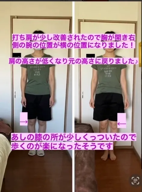 ルフレの神経矯正・筋膜リリース