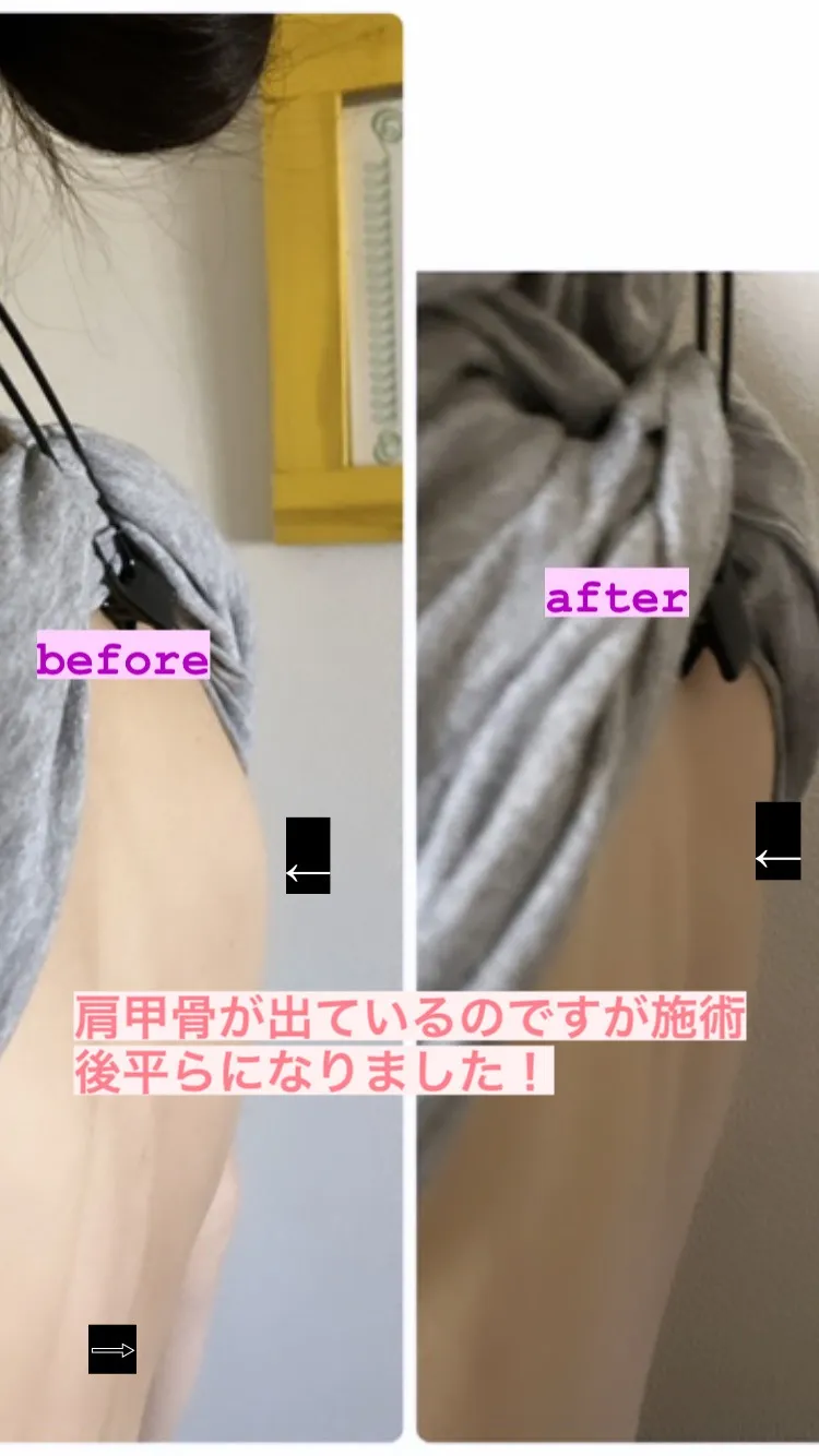 ルフレの神経矯正・筋膜リリース・骨格矯正